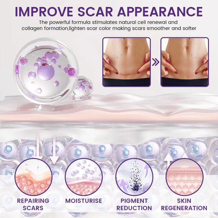 ReGenScar Stem Cell Repair Gel (Improvement in 7 Days) Buy one get one free